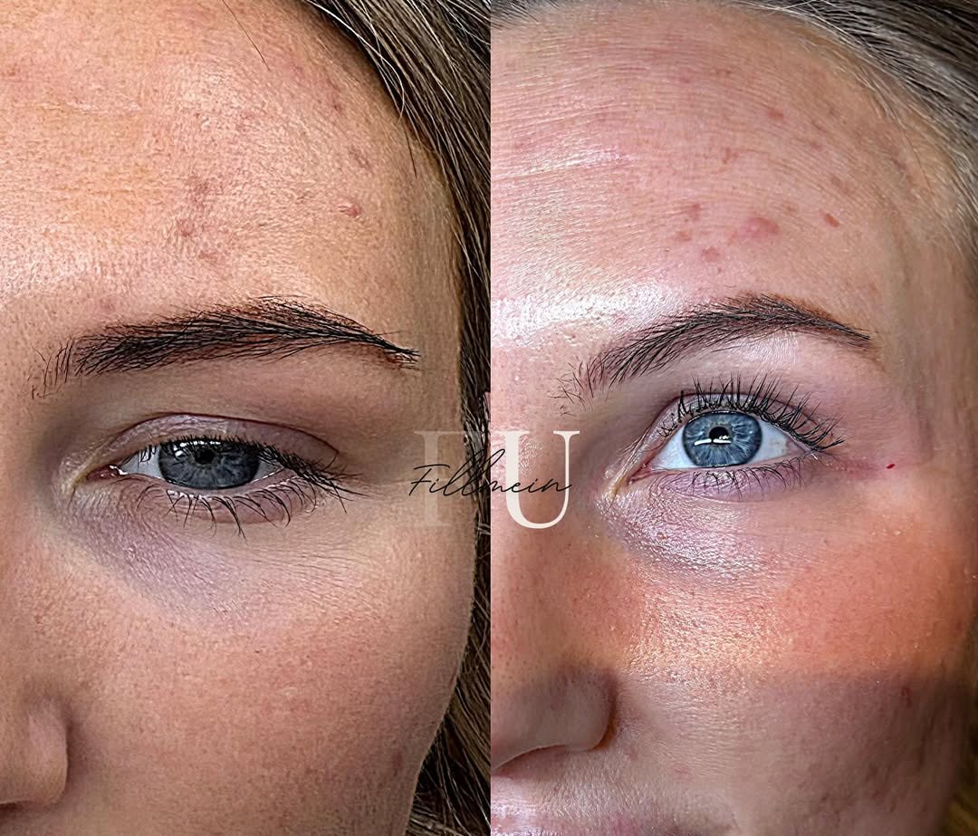 Eyebrow and lash enhancement results